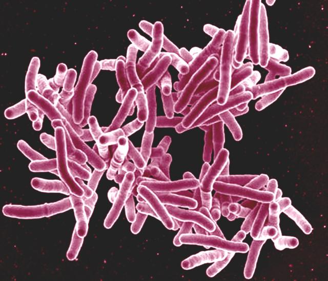 Mycobacterium_tuberculosis_Bacteria,_the_Cause_of_TB_(5149398656).jpg